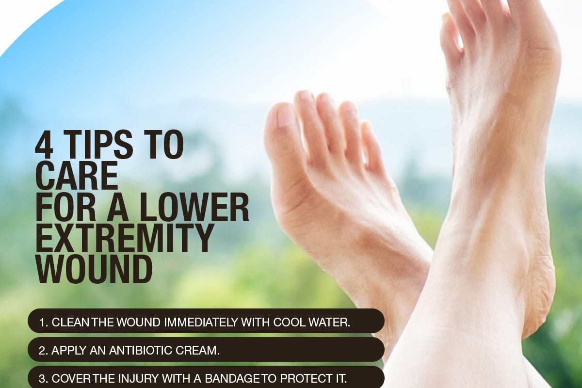 4 Tips to Care for a Lower Extremity Wound [Infographic]