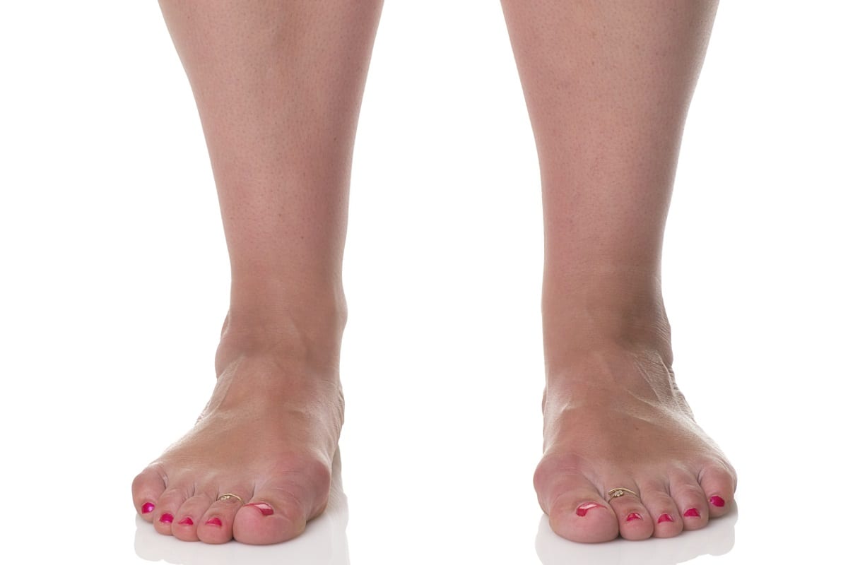 How Diabetes Affects Your Feet & What to Do