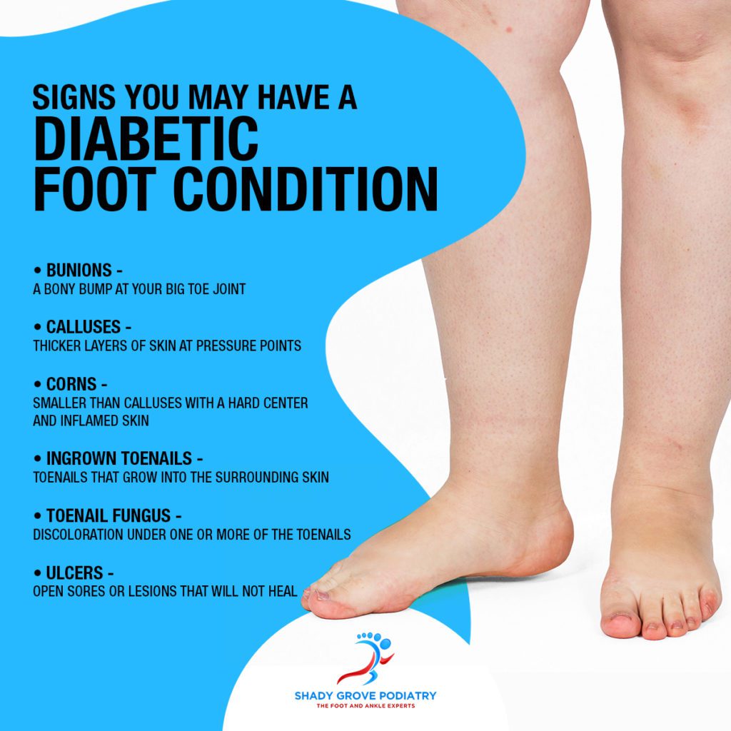 Diebetic Foot Condition Infographic Oct 2021
