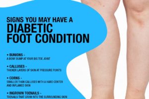 Diabetic Foot Condition Infographic
